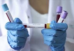 В Азербайджане выявлено еще 3469 случаев заражения коронавирусом